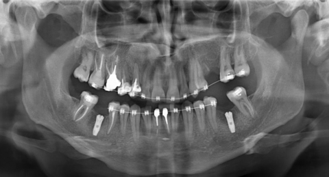 Рентген и диагностика зубов