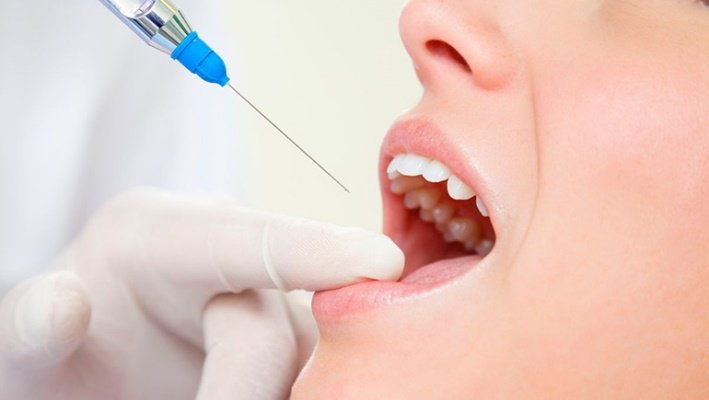 Виды анестезии в стоматологии