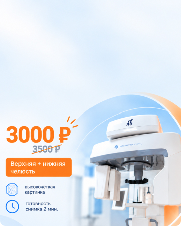 3D-томография зубов