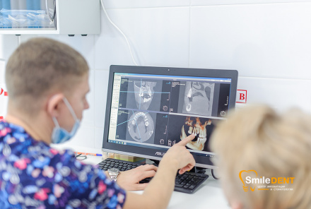 Когда пора ставить имплант? Отсутствие зуба — это не только косметический дефект