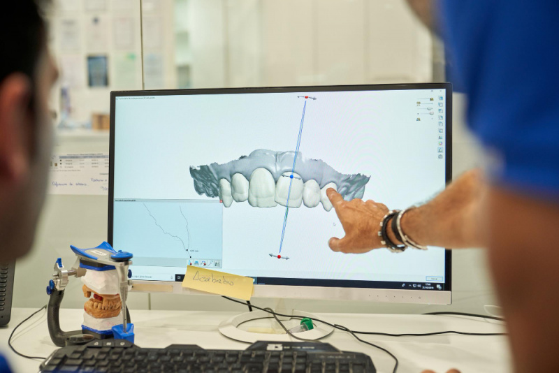 Протезирование зубов CAD/CAM — консультация и лечение